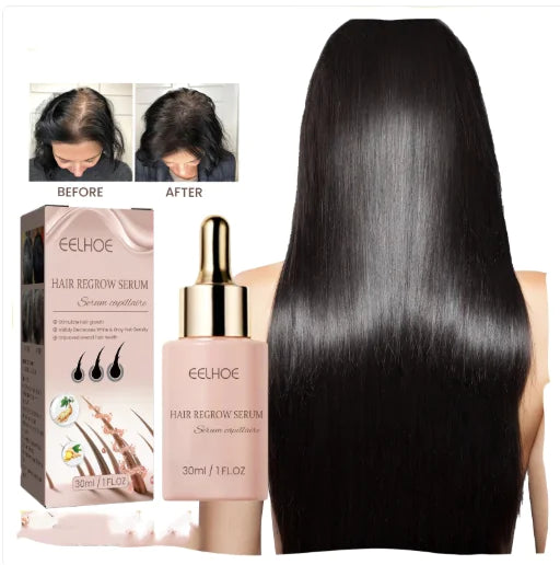 EELHOE Essence Dense pour Cheveux Anti-Chute et Fixation des Cheveux Nutrition